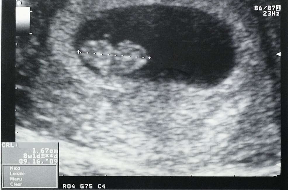 A picture is&nbsp;worth…